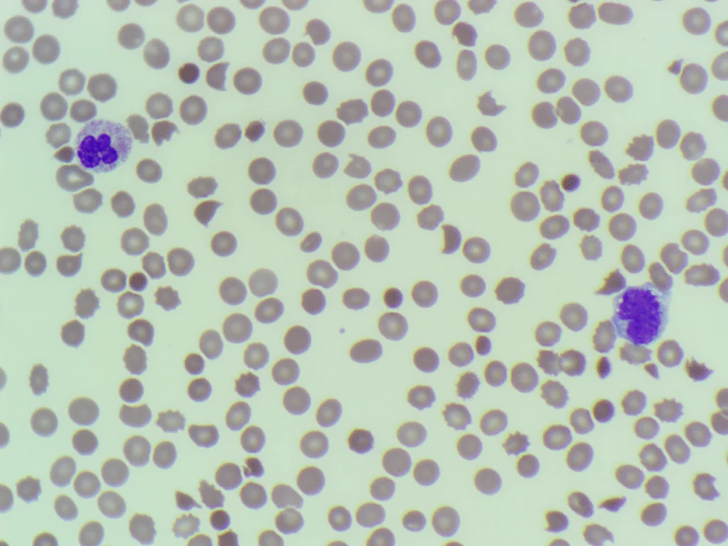 A stained blood film seen down the microscope, with red cells and two neutrophils.