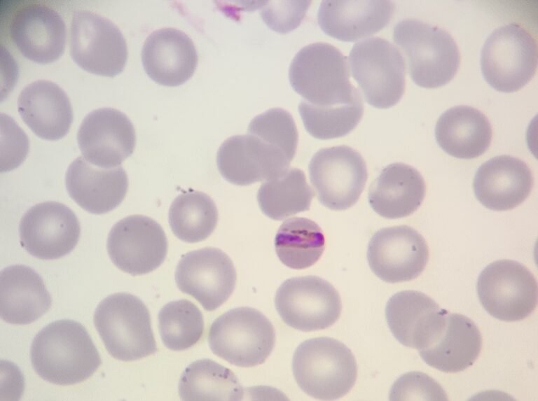 MM251020: P. malariae