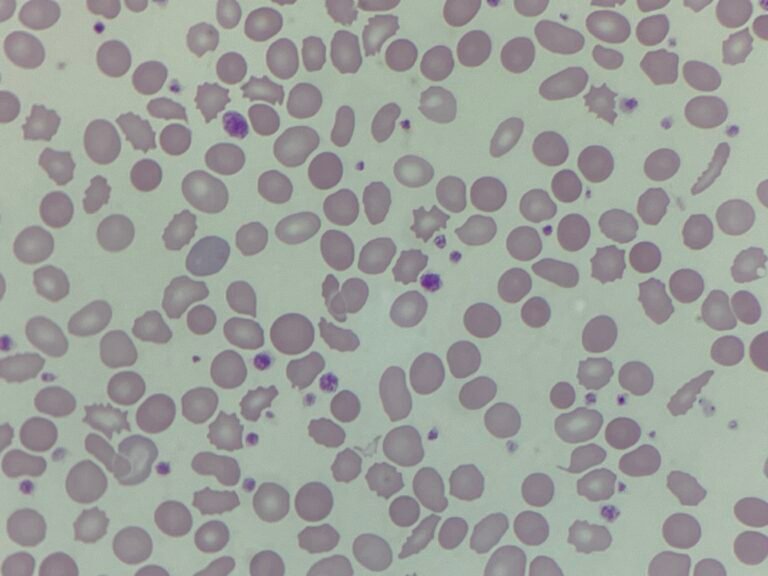 Morphology Monday | Case MM250929