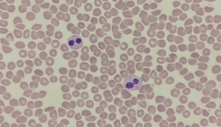 Bilobed neutrophils