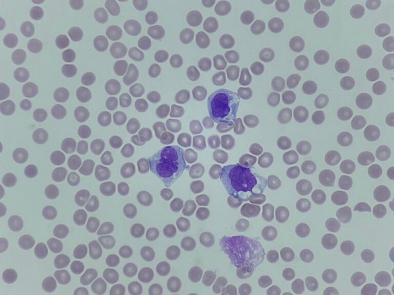 20220130_211328066_iOS