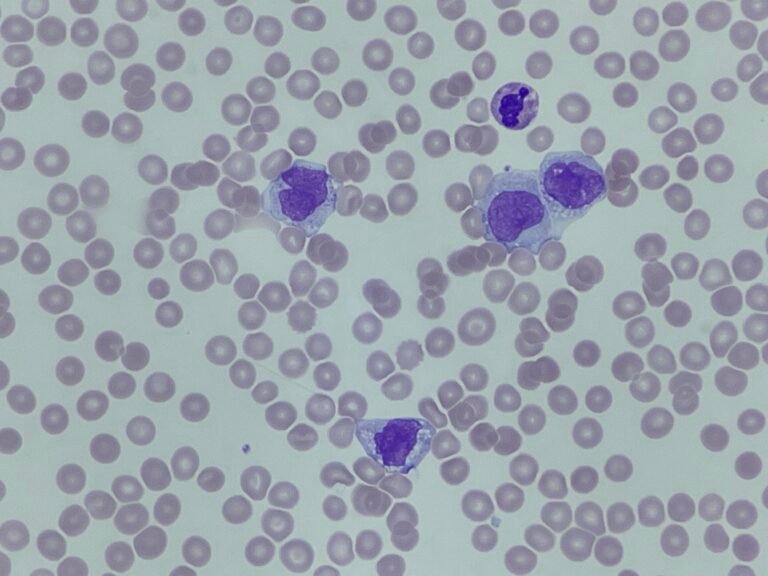 20220130_211459264_iOS