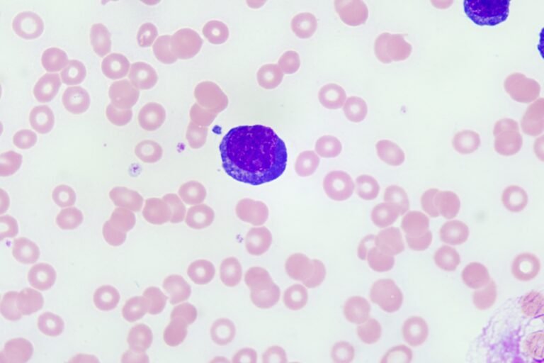 Plasma cell