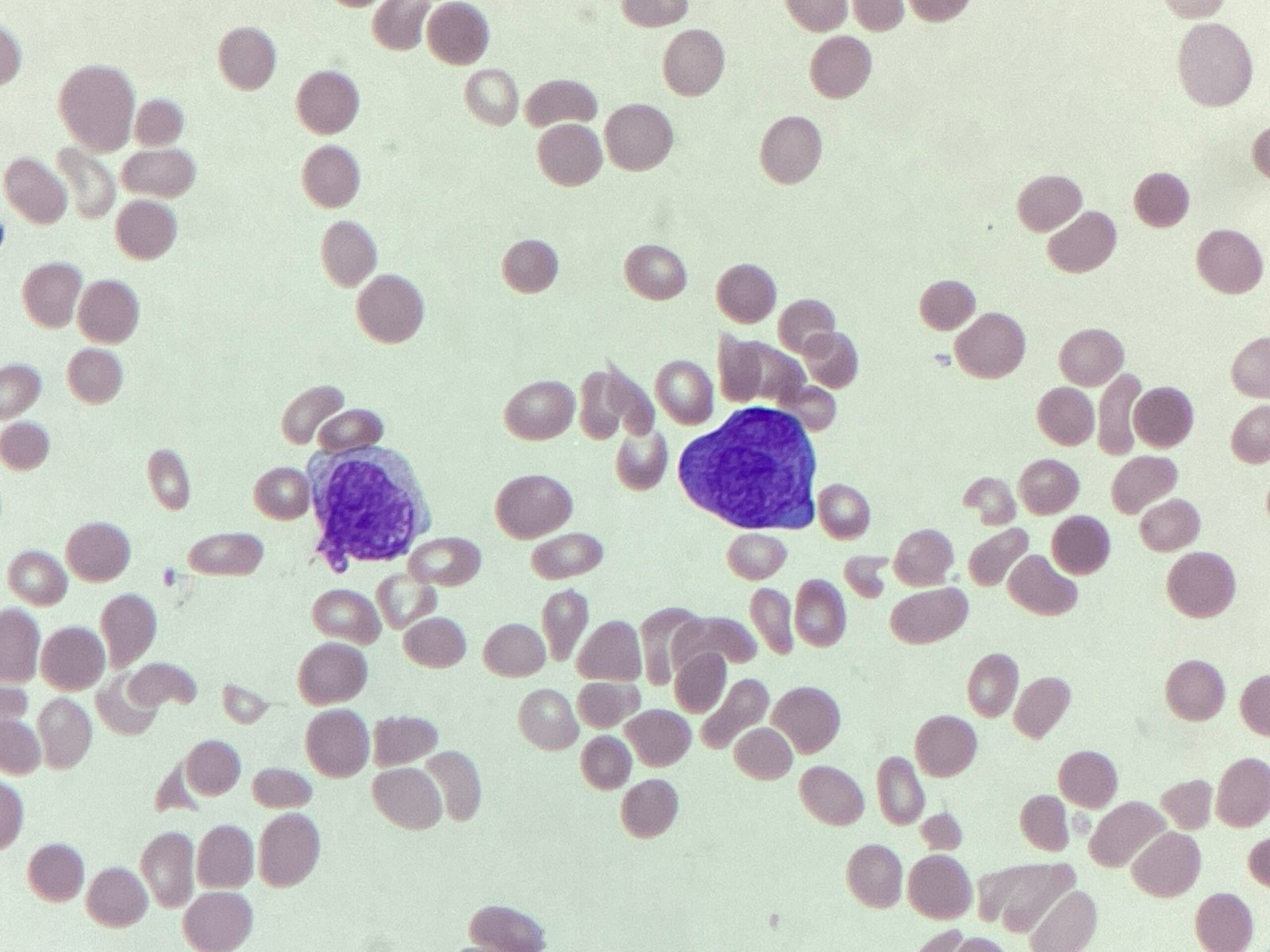 Morphology Monday | Case MM251013