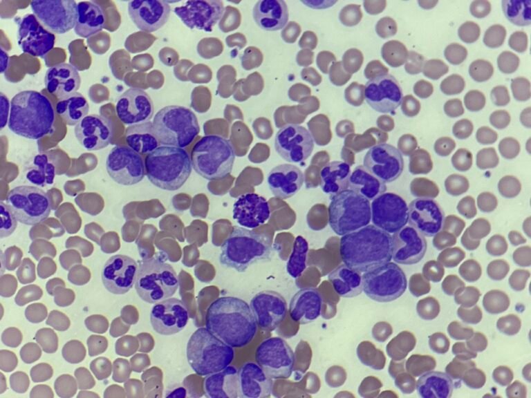 Morphology Monday | Case MM250609