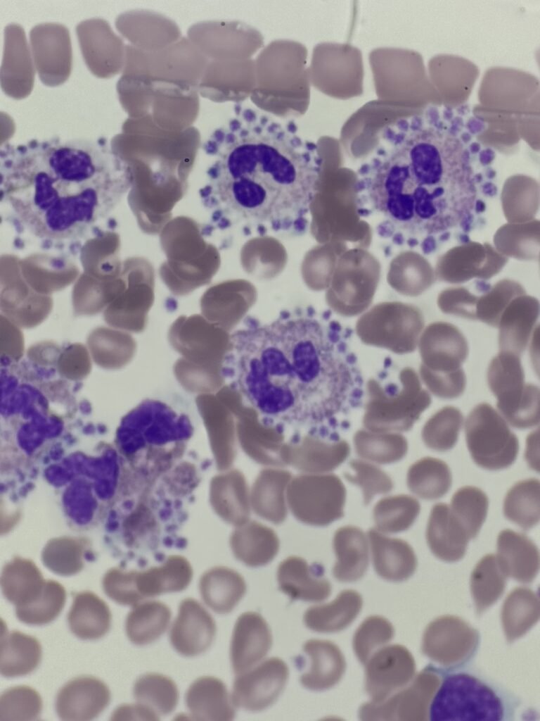platelet-satellitism_02-1